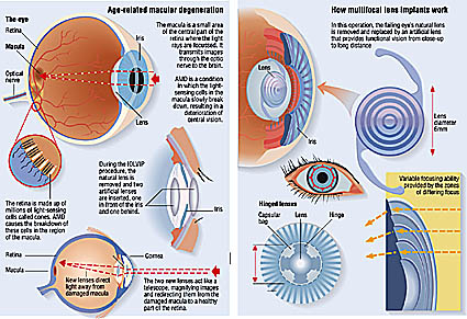 eye illustration medical diagram