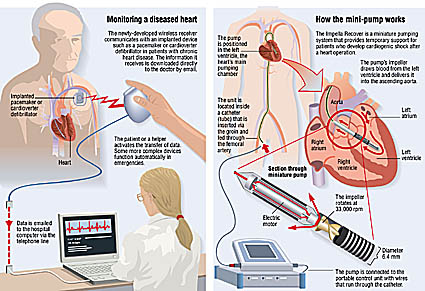 heart diagram medical illustration