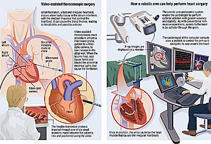 robotic surgery medical illustrations